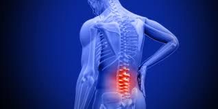 Ankylosing spondylitis treatment
