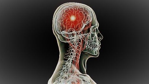 Brain cancer treatment