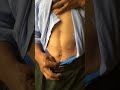 Stomach cancer survivor